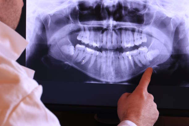 Best Emergency TMJ Treatment in Miamisburg, OH