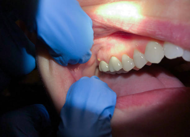 Best Emergency TMJ Treatment in Miamisburg, OH