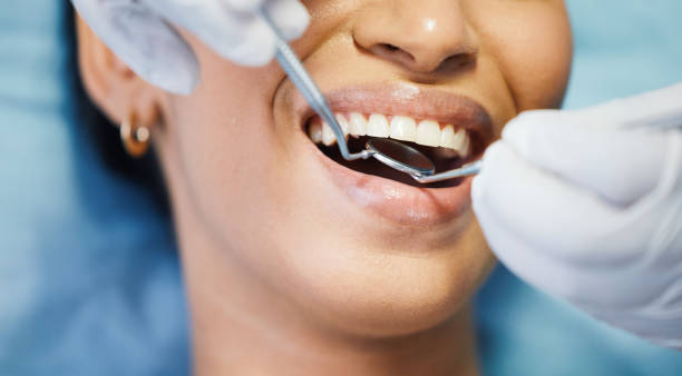 Best Emergency Gum Treatment in Miamisburg, OH