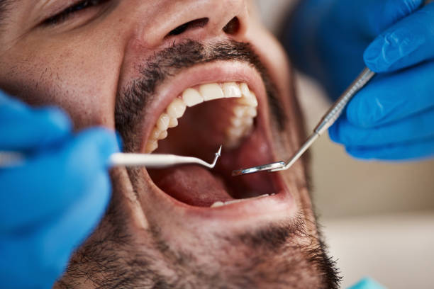 Best Emergency Dental Care for Broken or Chipped Teeth in Miamisburg, OH